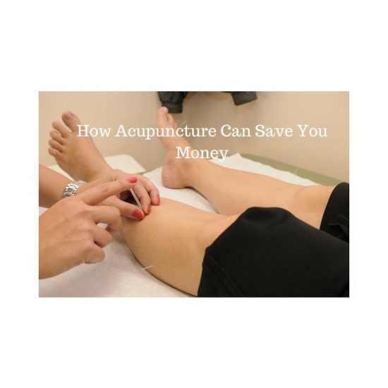 How Acupuncture Can Save You Money