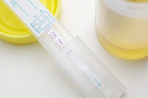 Why Should Drug Testing in the Workplace Be Encouraged?
